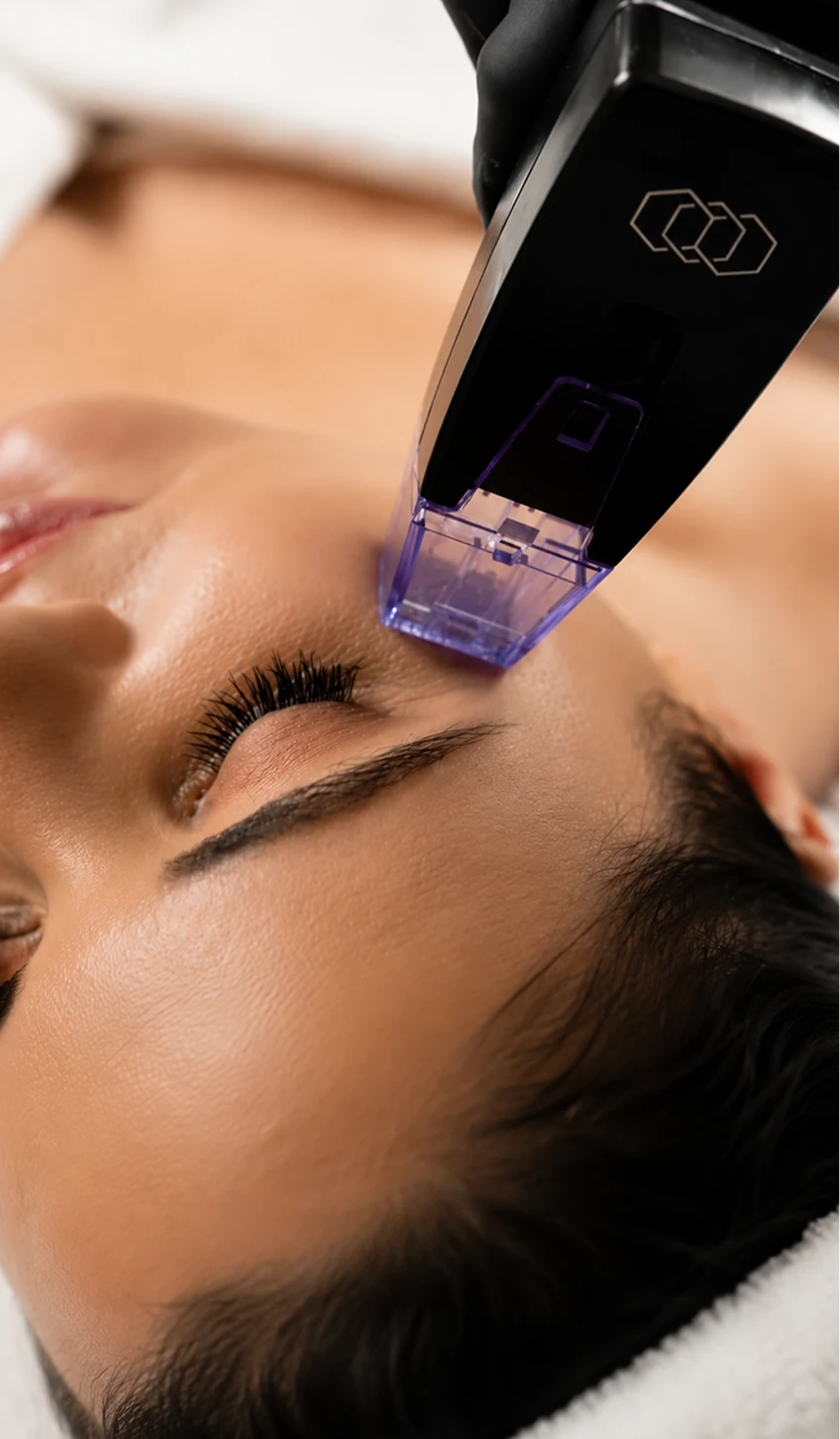 Morpheus8 RF microneedling skin tightening at Elevate Aesthetics Glendale, CA